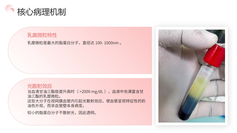 视网膜脂血症护理查房带参考文献_第5页