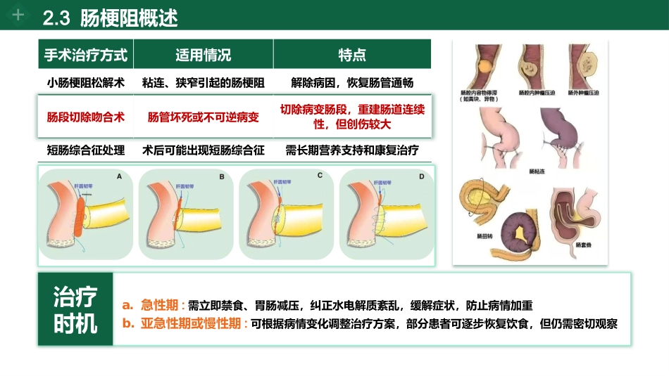 肠梗阻个案护理_第6页