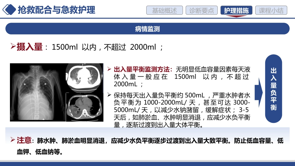 急性心力衰竭的护理讲课_第15页