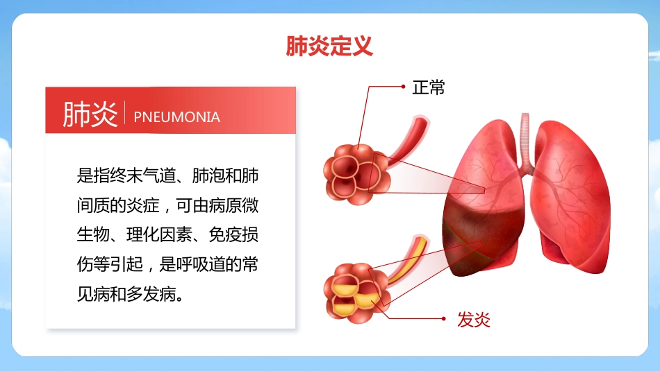 儿童肺炎护理_第5页