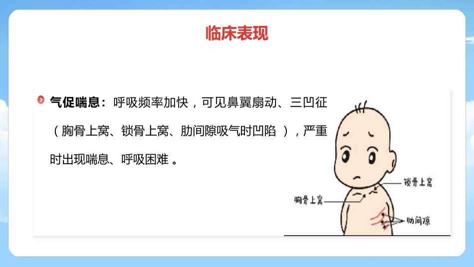 儿童肺炎护理_第9页