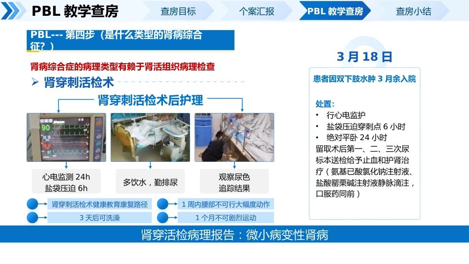 一例肾病综合症PBL护理教学查房_第11页