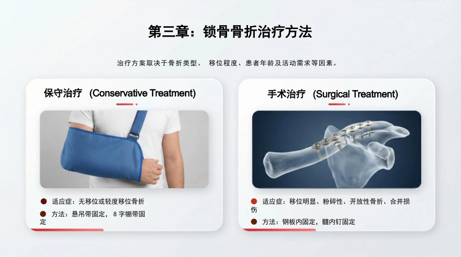 锁骨骨折_第13页