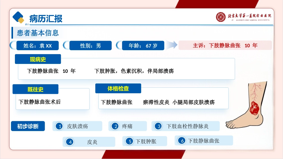 一例下肢静脉溃疡的护理pptx_第4页