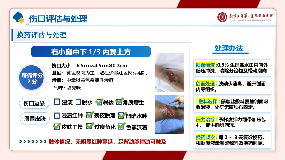 一例下肢静脉溃疡的护理pptx_第9页