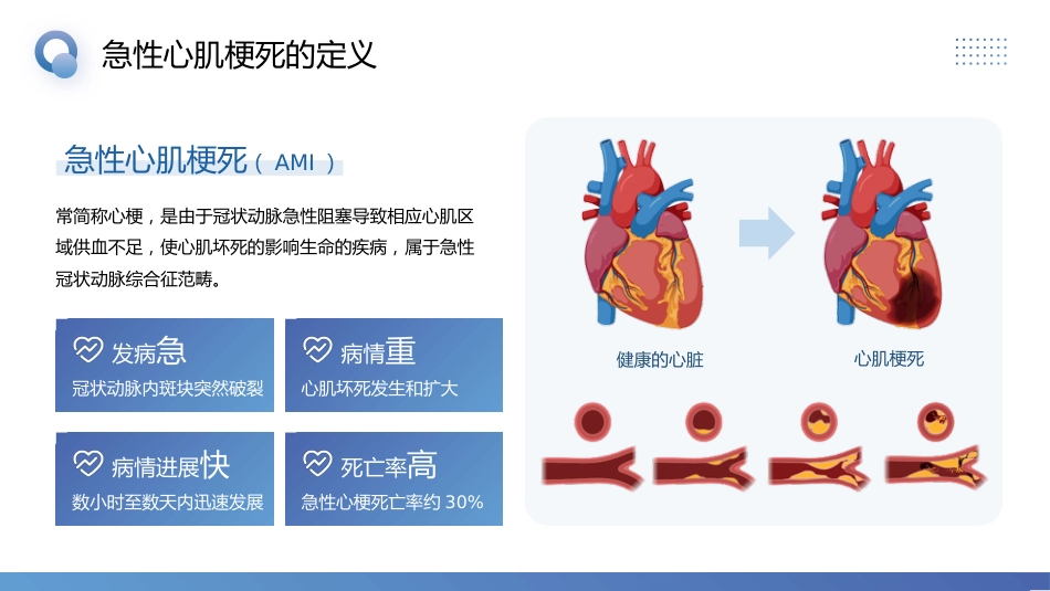 急性心肌梗死预防与护理_第4页