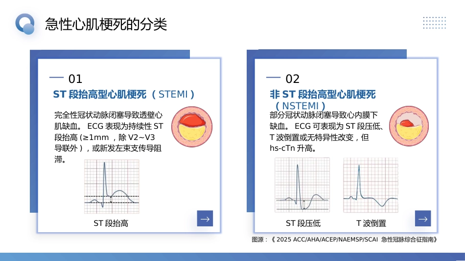 急性心肌梗死预防与护理_第5页