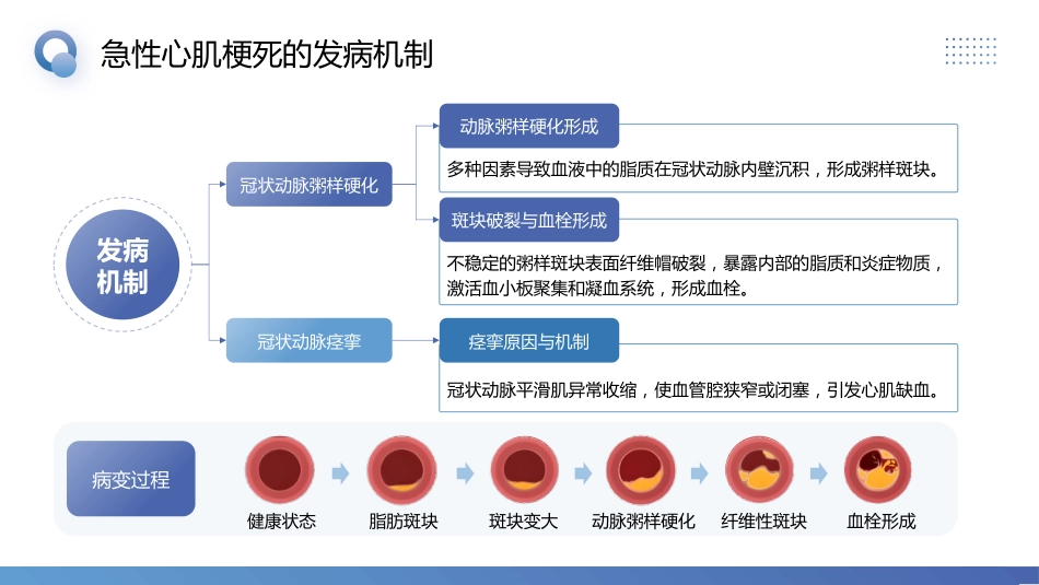 急性心肌梗死预防与护理_第6页