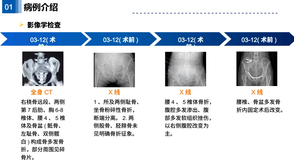 一例骨盆多发骨折并发失血性休克的个案护理_第9页