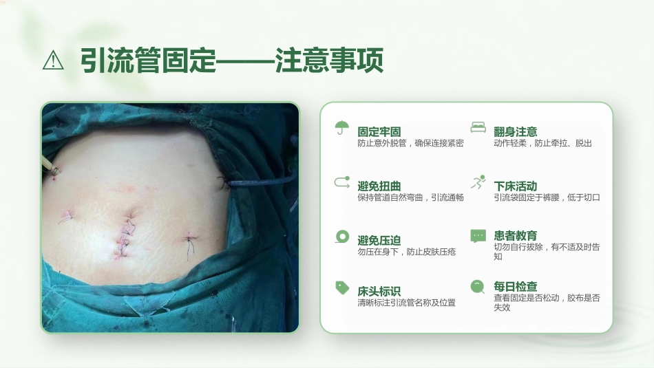腹腔引流管护理规范_第12页