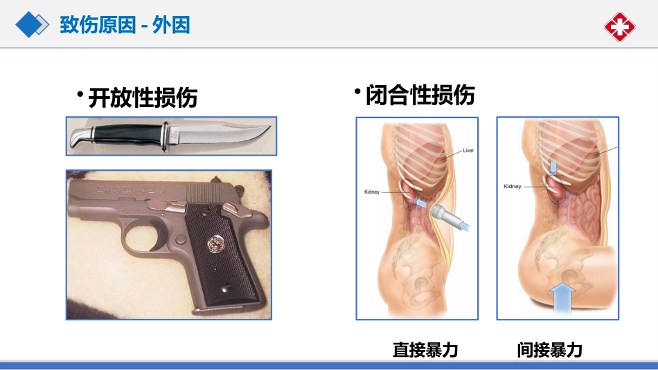 肾脏损伤的诊治(肾创伤)_第10页