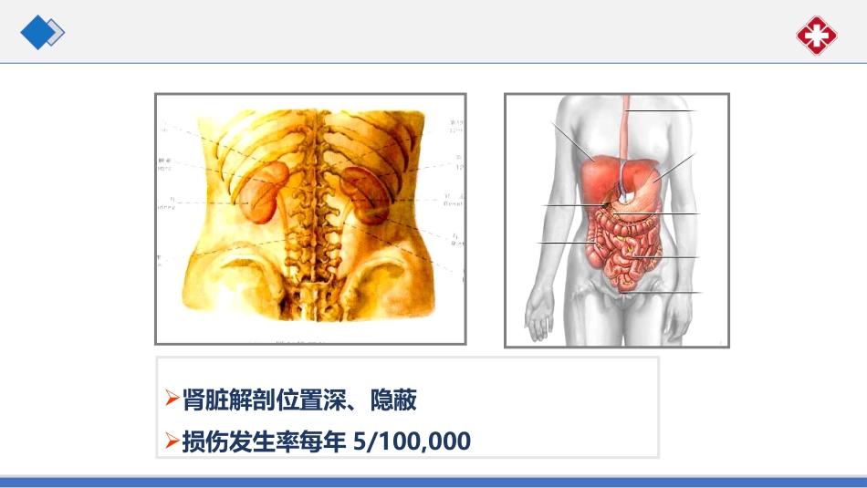 肾脏损伤的诊治(肾创伤)_第5页