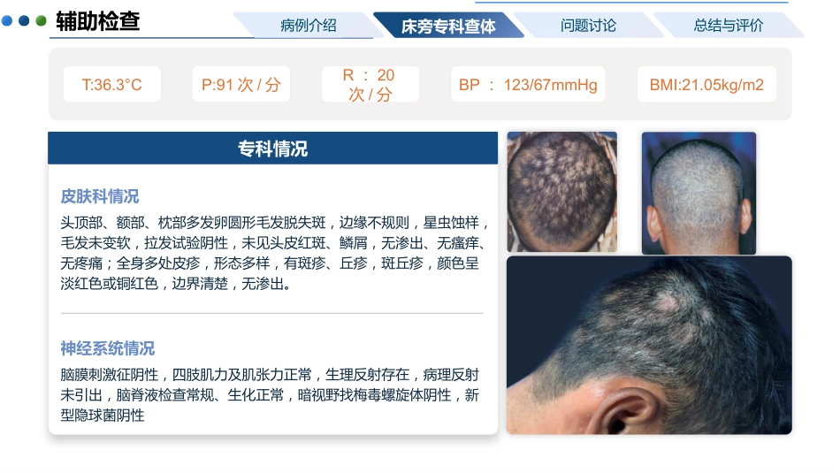 一例神经梅毒患者的护理教学查房_第5页