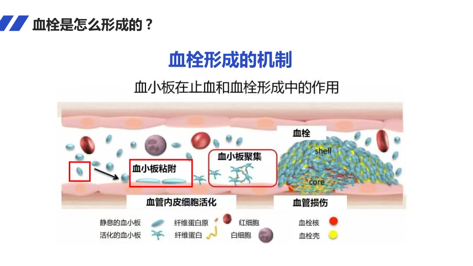 PICC导管血栓的护理_第4页