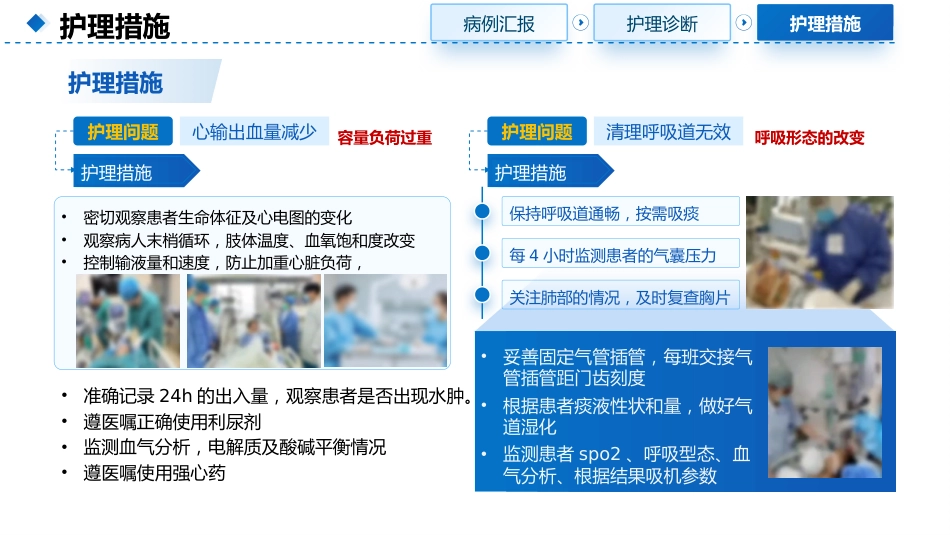一例呼吸衰竭合并心功能不全使用IABP的患者护理查房_第12页