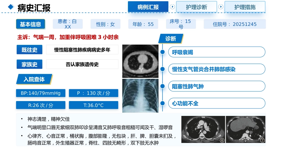 一例呼吸衰竭合并心功能不全使用IABP的患者护理查房_第4页