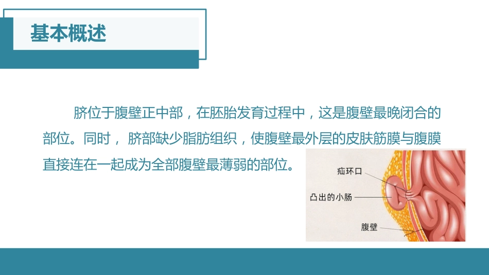 脐疝的护理查房_第3页