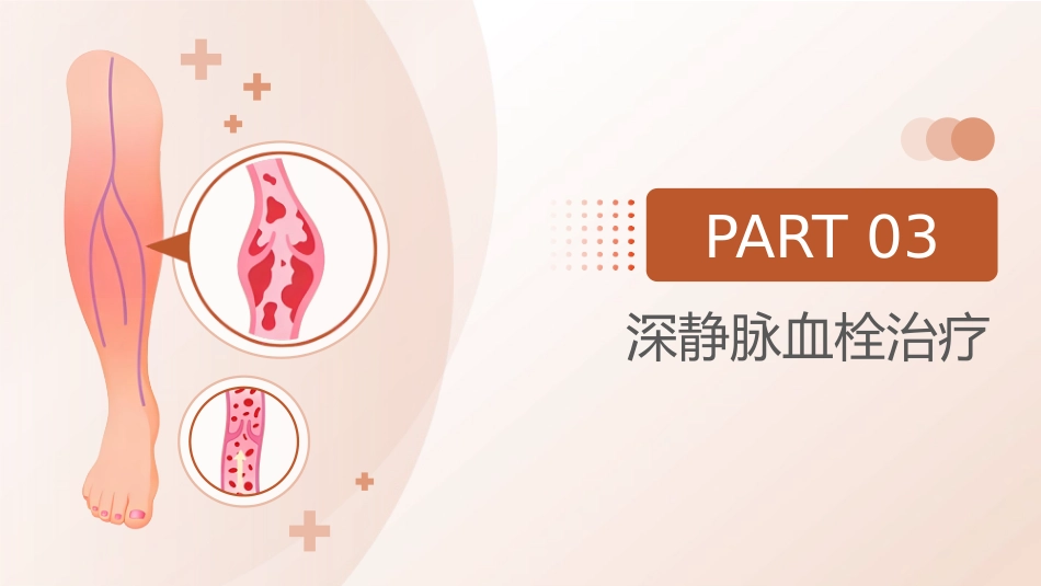 深静脉血栓预防管理讲座_第13页