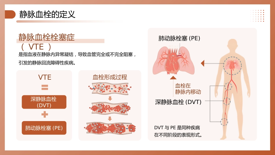 深静脉血栓预防管理讲座_第4页