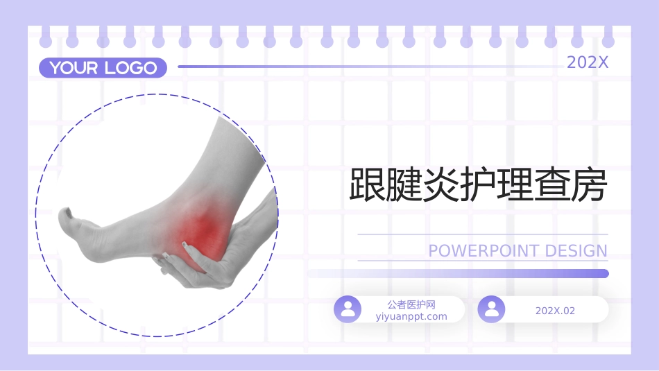 跟腱炎护理查房带参考文献_第1页