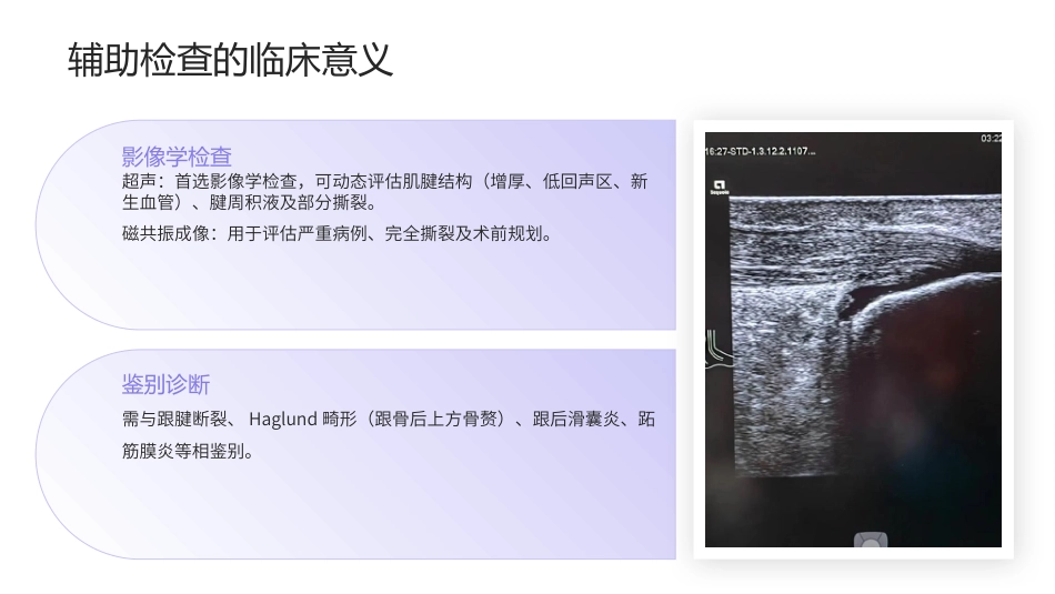 跟腱炎护理查房带参考文献_第10页
