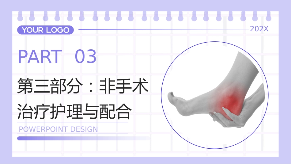 跟腱炎护理查房带参考文献_第11页