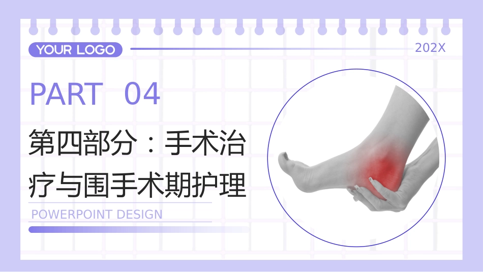 跟腱炎护理查房带参考文献_第15页
