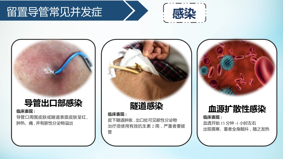血液透析留置导管护理_第15页