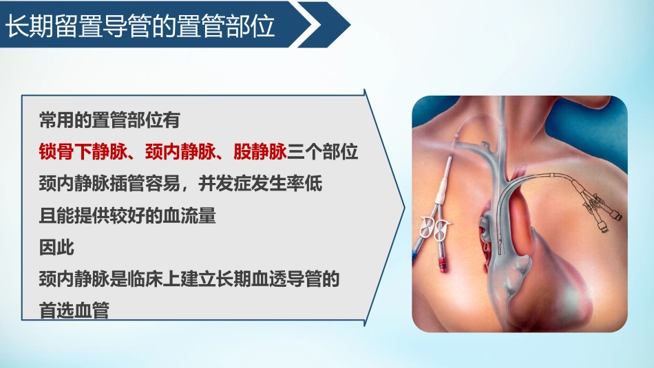 血液透析留置导管护理_第7页