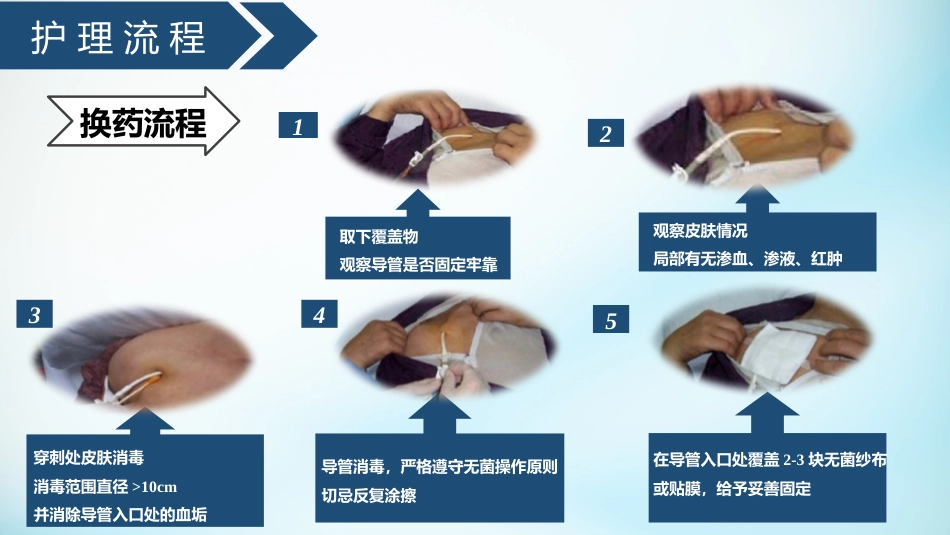 血液透析留置导管护理_第8页
