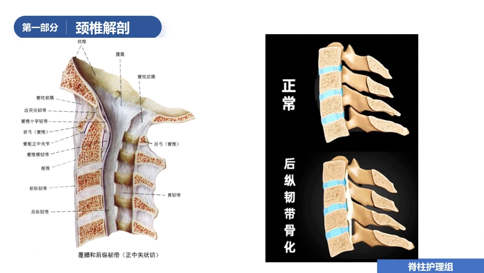 1例颈椎后路单开门减压手术的护理查房_第6页