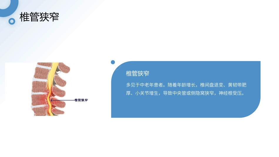 坐骨神经痛护理查房带参考文献_第10页