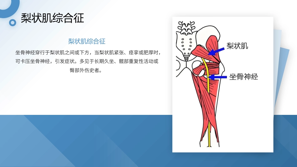 坐骨神经痛护理查房带参考文献_第11页