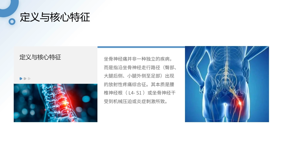 坐骨神经痛护理查房带参考文献_第4页