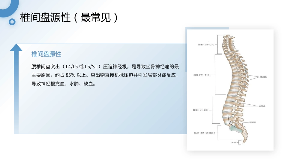 坐骨神经痛护理查房带参考文献_第9页