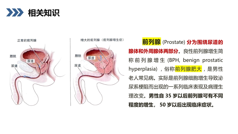 前列腺增生护理查房_第4页