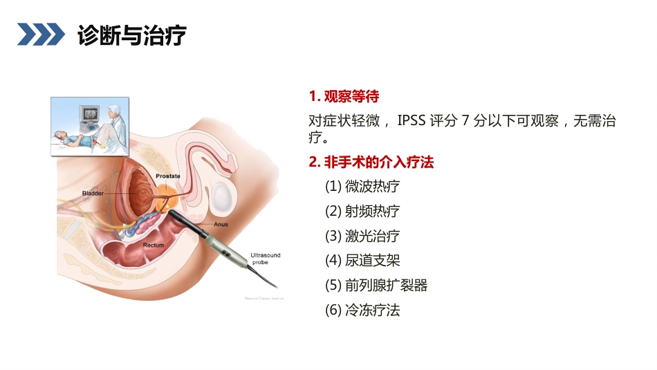 前列腺增生护理查房_第7页