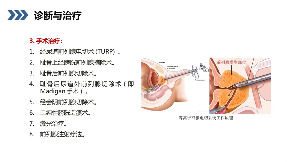 前列腺增生护理查房_第8页