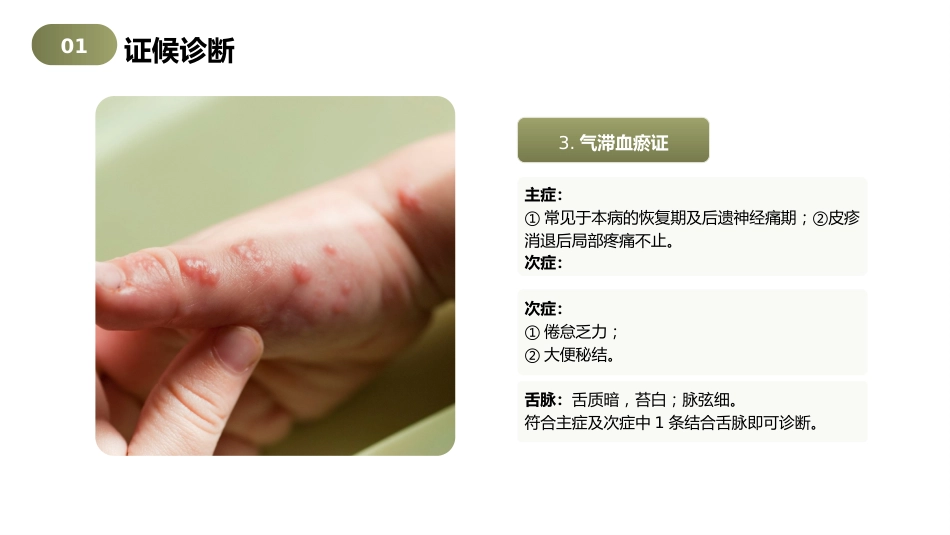 带状疱疹（蛇串疮）中医护理查房2_第8页