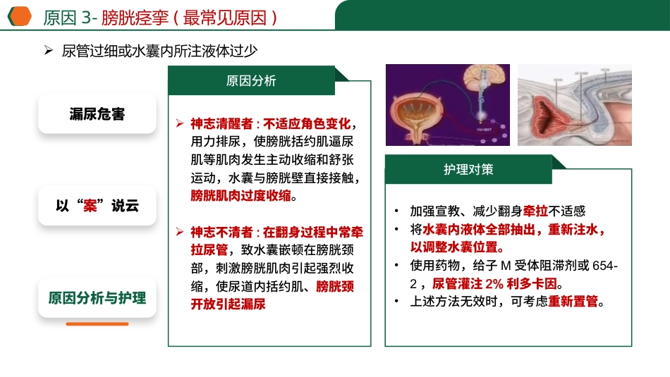 留置导尿患者漏尿_第14页