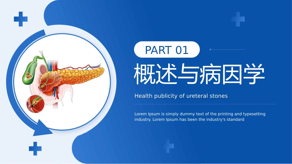 输尿管结石宣教_第3页