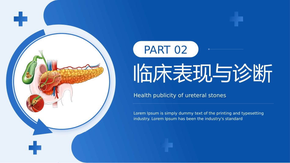 输尿管结石宣教_第7页
