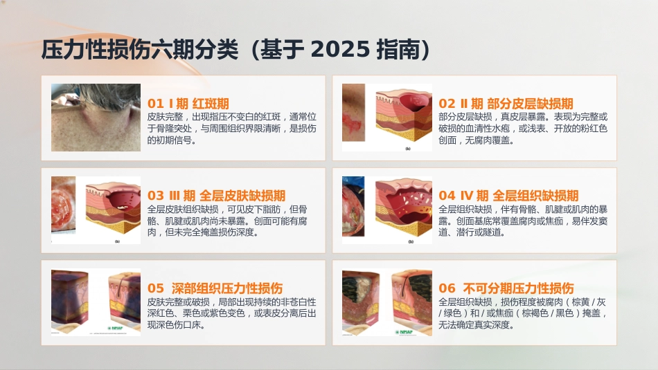 压力性损伤的预防与护理_第12页