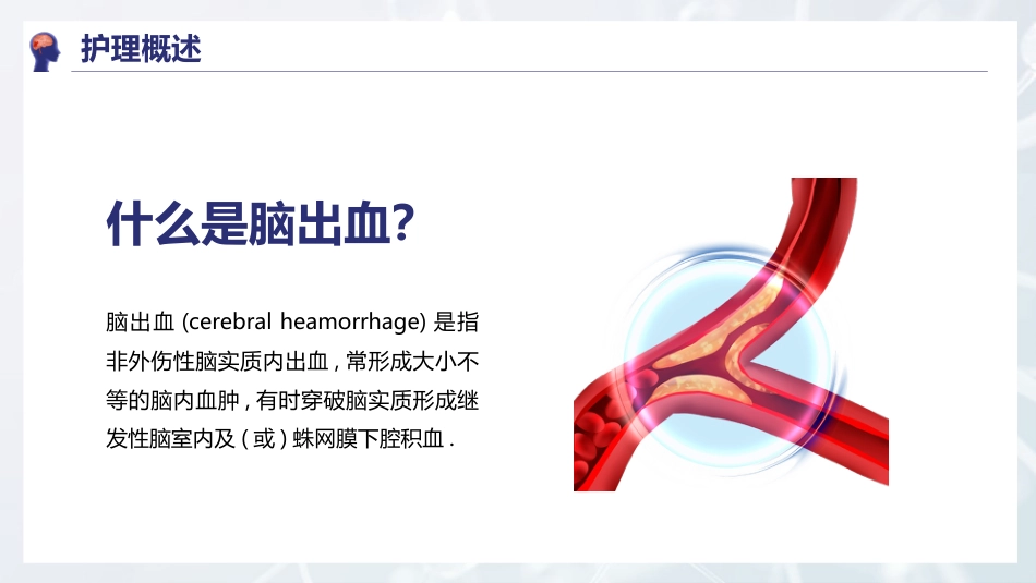 脑出血护理方案_第4页