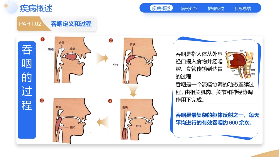 一例脑卒中合并吞咽障碍患者的个案护理教学查房_第4页