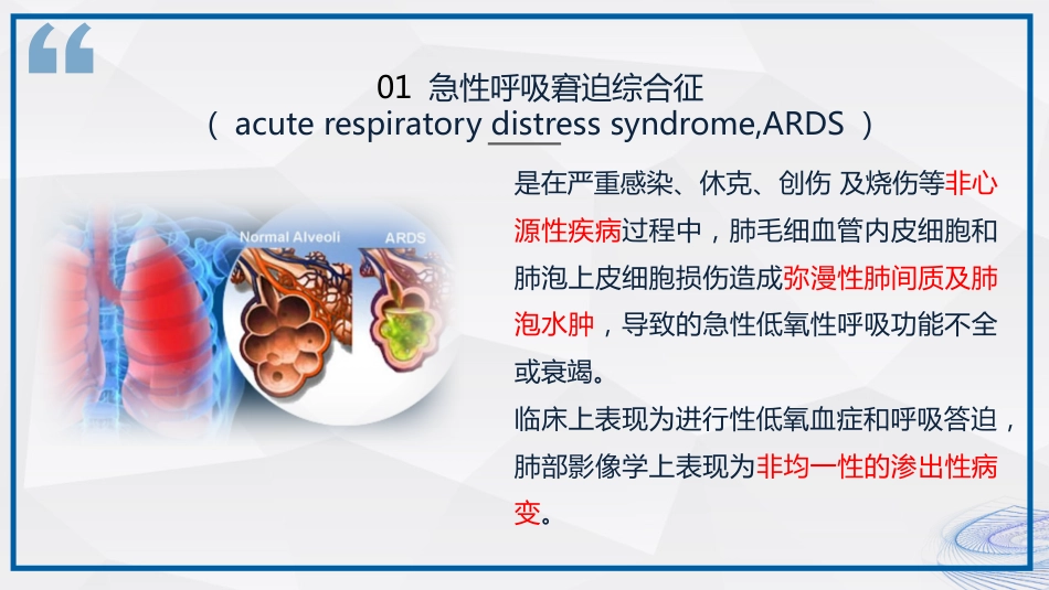 急性呼吸窘迫综合征ARDS患者的护理_第5页