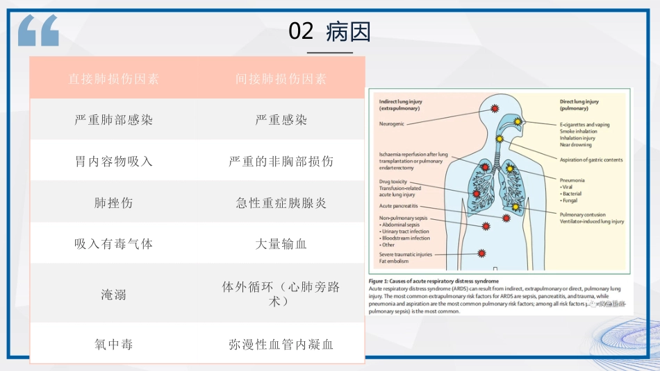 急性呼吸窘迫综合征ARDS患者的护理_第7页