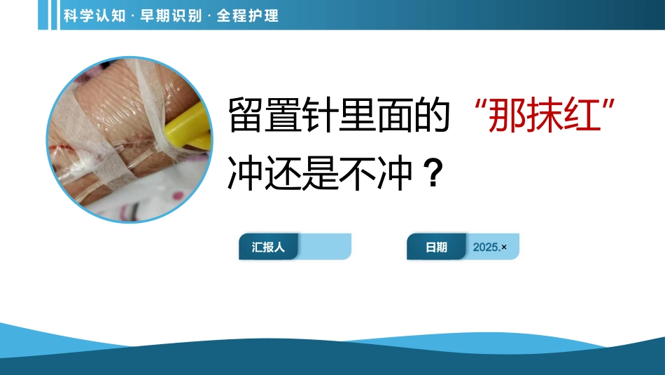 留置针冲管科普PPT_第1页