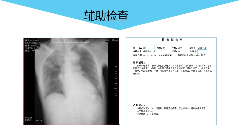 脑出血的护理个案分享_第14页