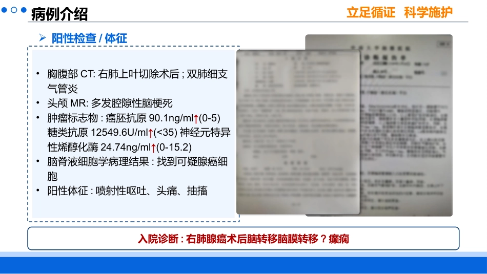 一例肺癌脑膜转移患者的循证护理_第4页